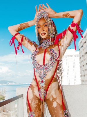 Winnie Harlow